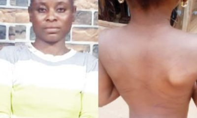 Police Rescues 6-year-old Girl Allegedly Tortured By Stepmother In Ogun