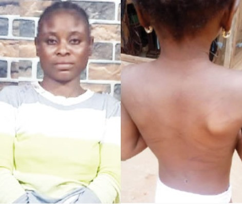 Police Rescues 6-year-old Girl Allegedly Tortured By Stepmother In Ogun