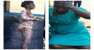 girl who was poured hot water in Kogi by her aunt