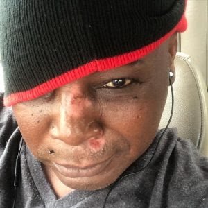 Charly Boy Scooter accident