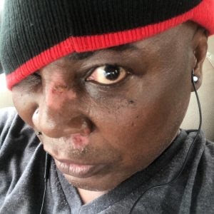 Charly Boy Scooter accident