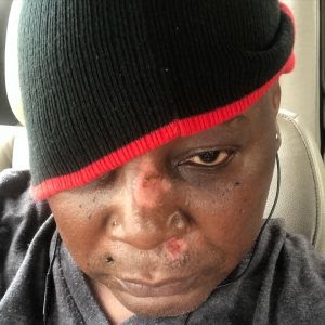 Charly Boy Scooter accident