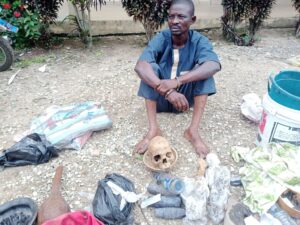 I Didn't Know Possession Of Human Skull Is An Offence- Herbalist Claims