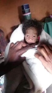 Shock As 20-Year-Old Woman Gives Birth To Strange Baby