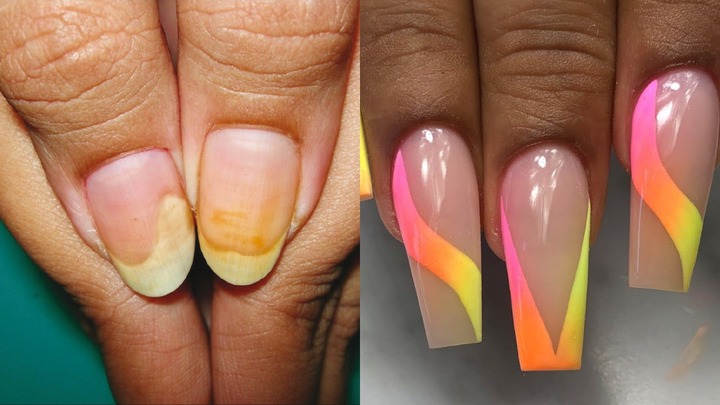 Artificial nails