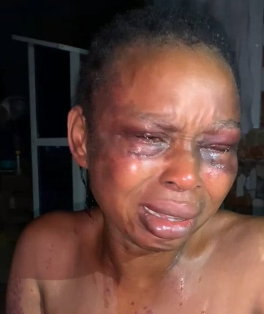 Elizabeth Olaniyonu's bloodied face after she was beaten by her husband, Shuaib Quadri