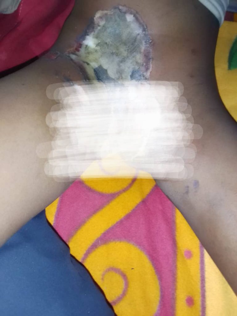 Woman Burns 7-Year-Old Girl’s Private Part With Hot Knife Over Witchcraft Allegation