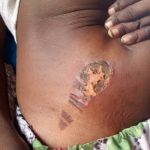 Bauchi Police Arrest Stepmother for Burning 5-Year-Old Over Bedwetting