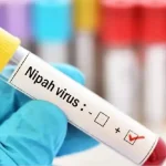 Nipah virus