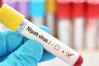 Nipah virus