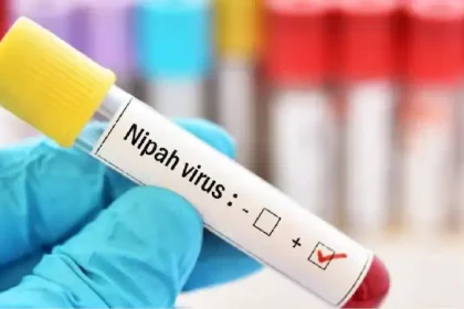 Nipah virus