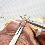 Vasectomy in Africa: The Silent Struggle Between Culture and Choice