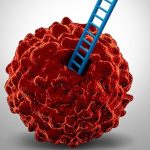 Prostate cancer cells (Photo: John Hopkins Medicine)