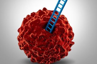 Prostate cancer cells (Photo: John Hopkins Medicine)