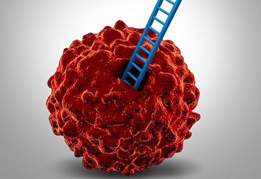 Prostate cancer cells (Photo: John Hopkins Medicine)