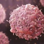 Oncologist Urges Nigerians to Act Early on Cancer Symptoms