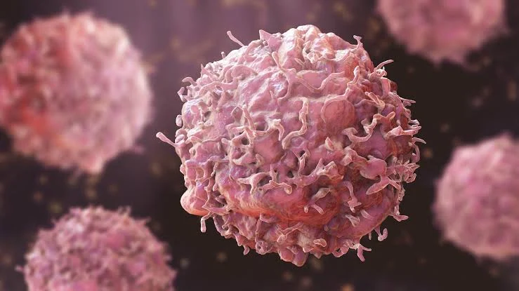 Oncologist Urges Nigerians to Act Early on Cancer Symptoms